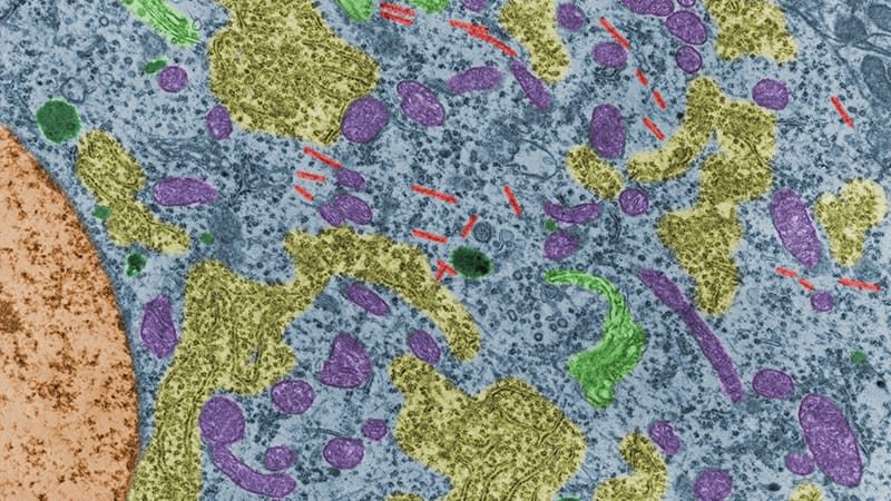 Could Carba1 Prevent Chemotherapy-Induced Neuropathy?