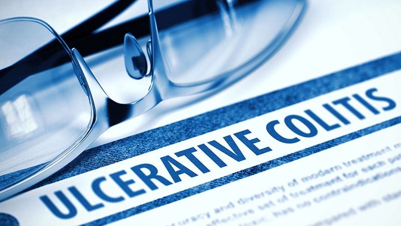 Mirikizumab Promising for Refractory Ulcerative Colitis