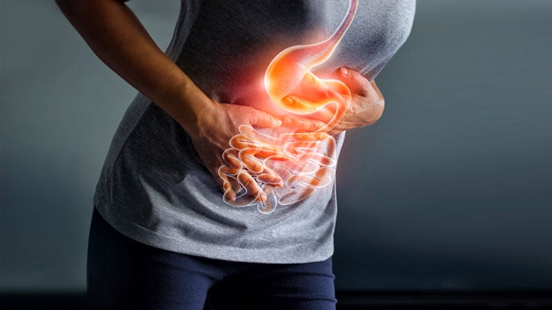 Fast Five Quiz: Gastric Cancer Diagnosis