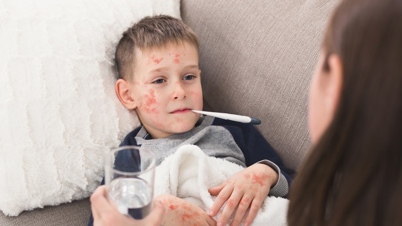 UK No Longer Measles-Free, WHO Warns