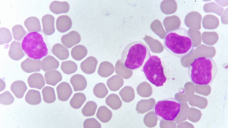 Pirtobrutinib Improves PFS in Treatment-Naive CLL/SLL