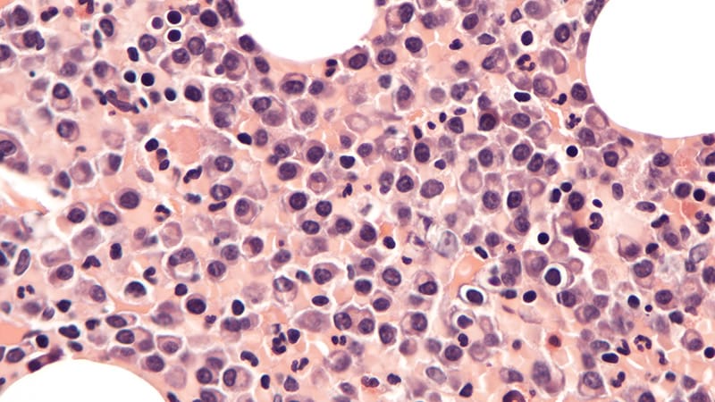 FDA Approves New Drug Combo for RR Multiple Myeloma