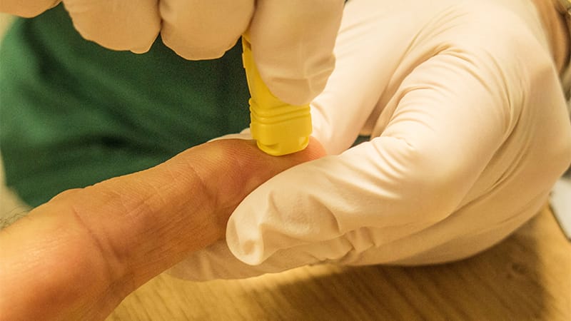 Finger-Prick Blood Test Shows Promise for Early AD Detection