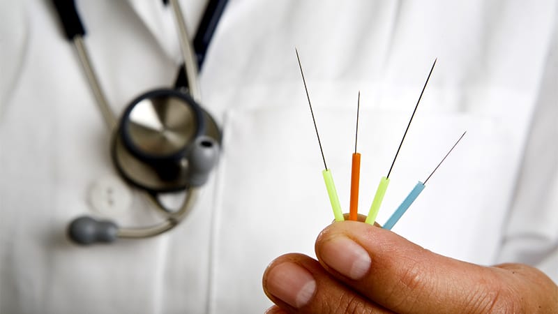 Acupuncture Promising for Migraine Without Aura