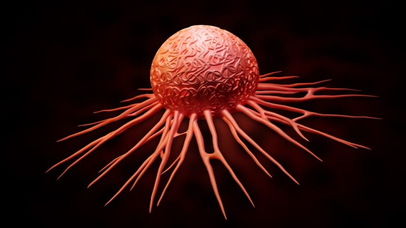 Mini-examen clínico: Urgencias oncológicas