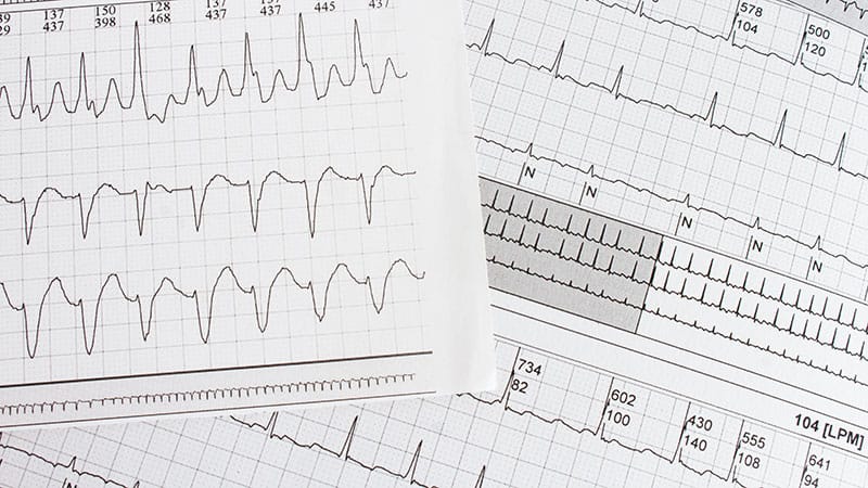 Six raisons pour lesquelles CHAMPION-AF ne devrait pas modifier les pratiques