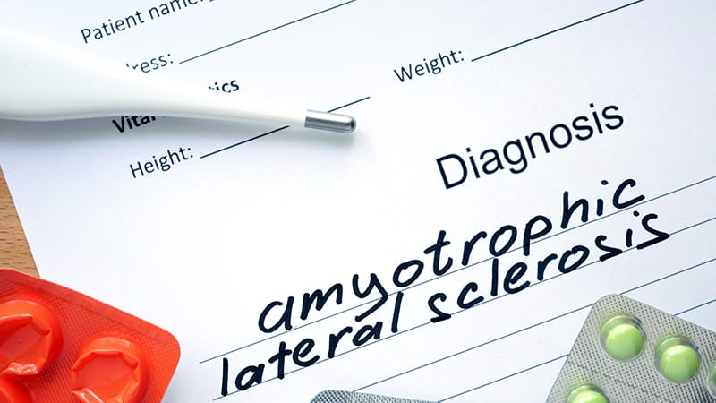 12% of Patients With ALS Survive At Least 10 Years
