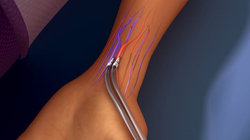 Children Born to Mothers on Dialysis Have High Morbidity