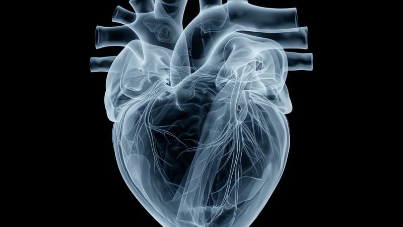 Propedêutica ampliada define etiologia na dor torácica sem DAC