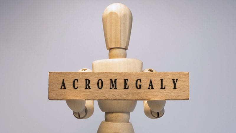 Oral Acromegaly Drug Performing Well in First Few Patients