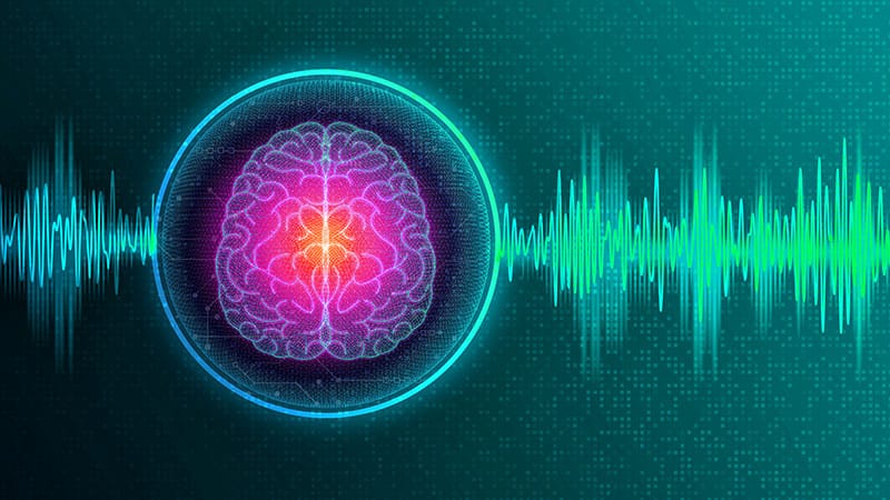 Fast Five Quiz: Brain Implants