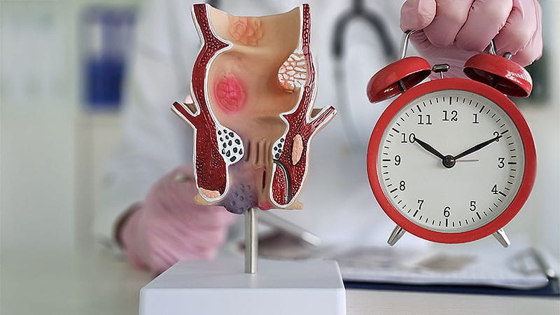 Early-Onset Colorectal Cancer Risk Factors Identified