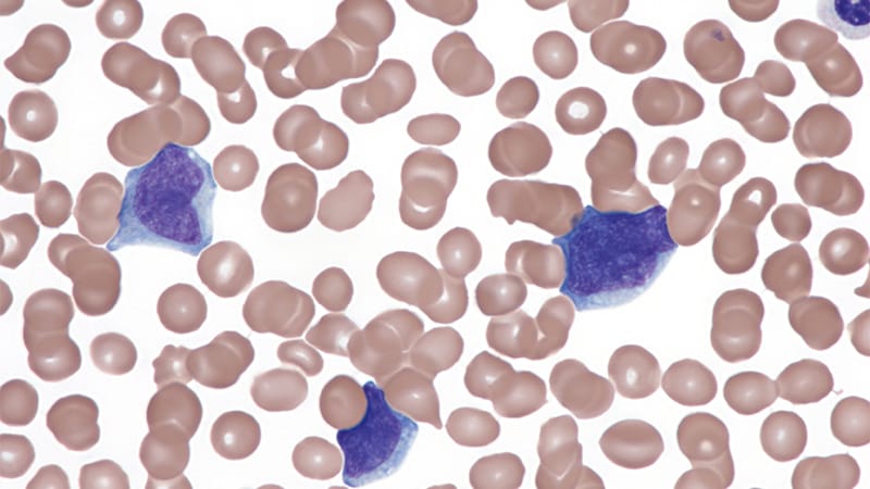 FDA Approves Novel Targeted Therapy for Rare Blood Cancer