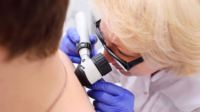Fast Five Quiz: Melanoma Adjuvant Treatment