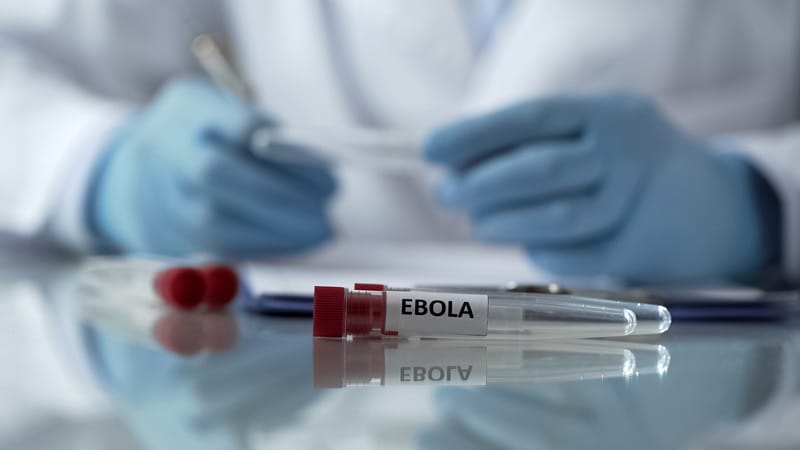 Teste Rápido: Abordagem inicial do paciente com suspeita de Ebola