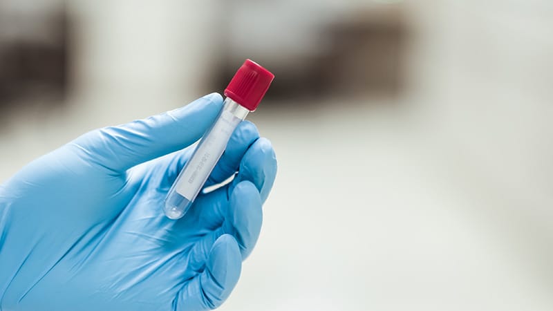 Des tests sanguins pour le diagnostic de la maladie d’Alzheimer