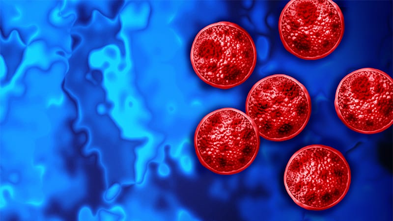 High Suspicion for Cyclosporiasis Needed, Tracing Continues
