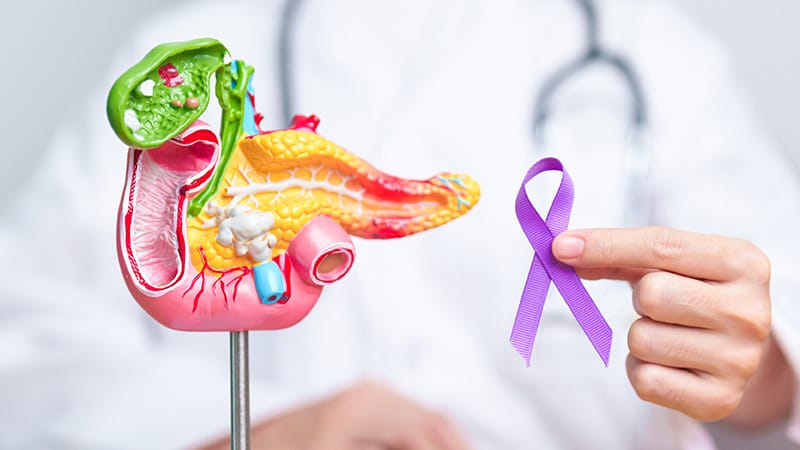 Quiz : facteurs de risque et dépistage du cancer du pancréas