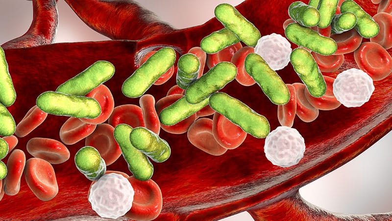 Fast Five Quiz: Sepsis