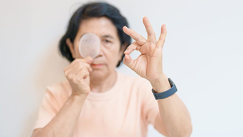 Fast Five Quiz: Thyroid Eye Disease Management