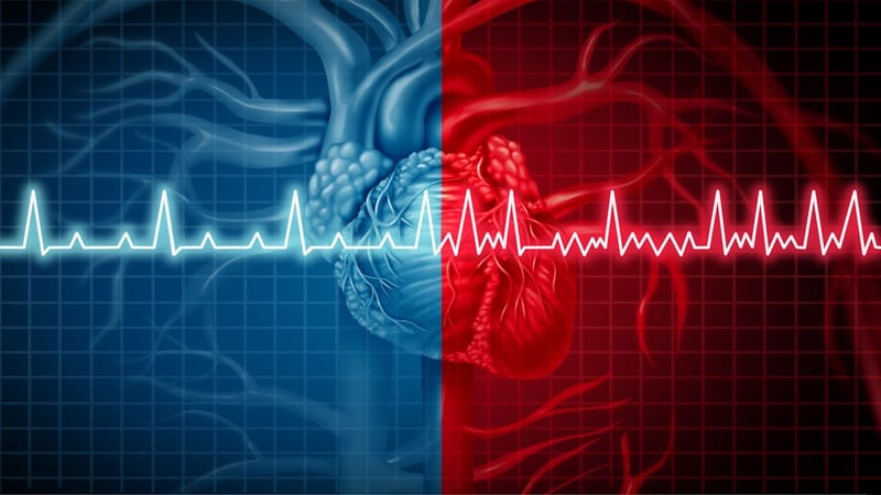 ECG Biomarker Predicts Atrial Fibrillation Risk Post-Stroke