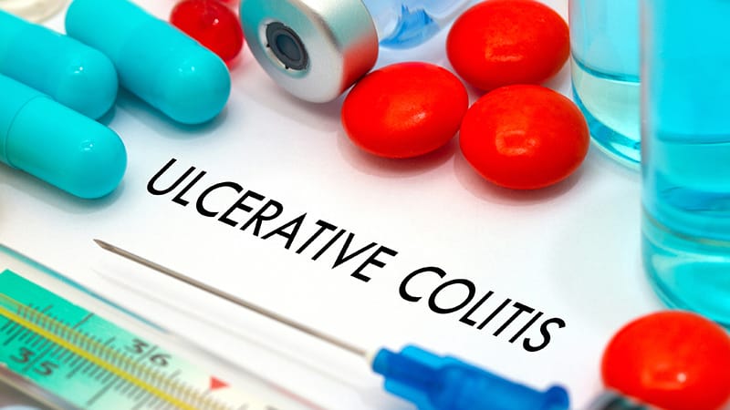 Oral IL-23 Inhibitor Shows Long-Term Safety, Efficacy in UC