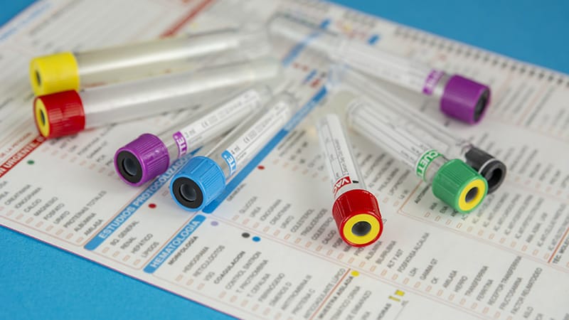 Blood-Based CRC Test Upgrades Improve on Lesion Detection