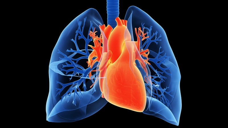 Lung Cancer Radiation May Up AF Risk