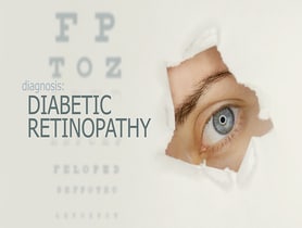 photo of diabetic retinopathy