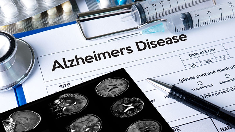 Critères révisés pour le diagnostic et la stadification de la maladie d’Alzheimer publiés
