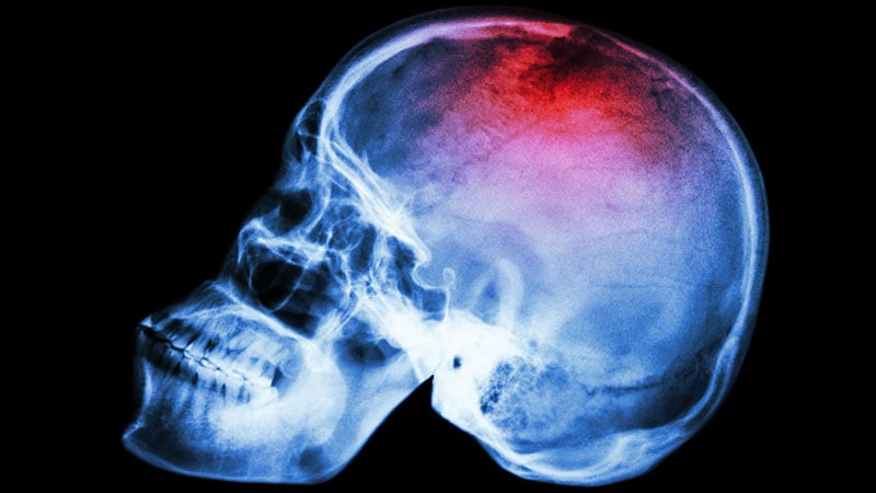 Adding Antithrombotic to tPA Does Not Improve Stroke Outcome