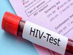 photo of HIV test