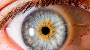 glp 1 and dry eyes Ozempic Face: What causes it how to prevent it? Can Popular GLP-1 Weight Loss