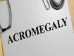 photo of  acromegaly