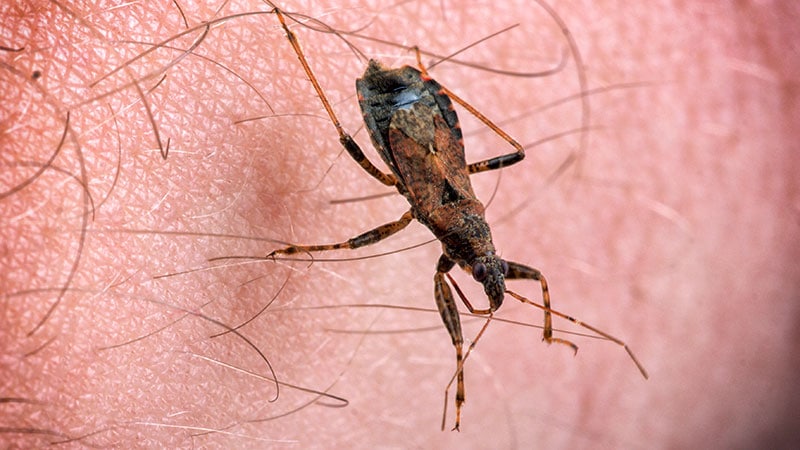 CDC Suspends Chagas Disease Testing