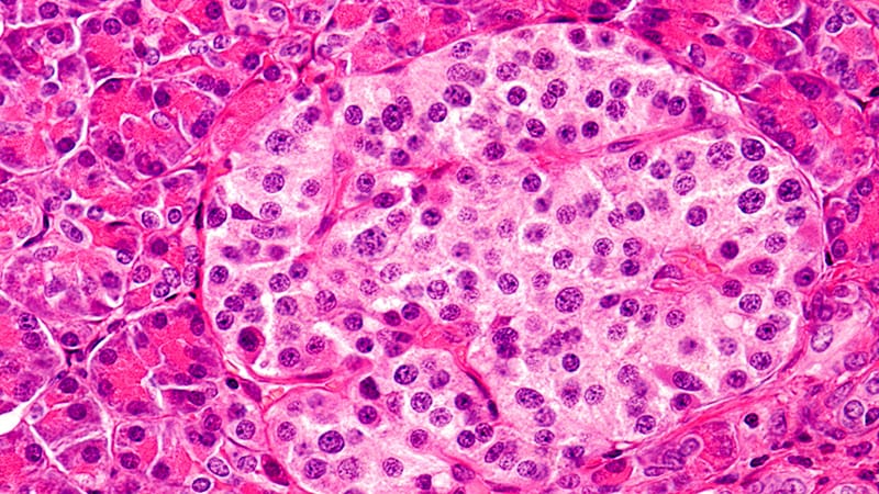 Efforts Address Immune Suppression in Islet Cell Transplants
