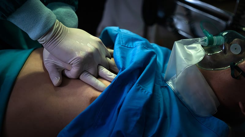 Perioperative Cardiac Arrest: Survival Is a Coin Flip
