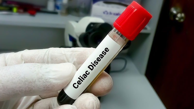 Do Acid-Suppressors in Early Life Lead to Celiac Disease?