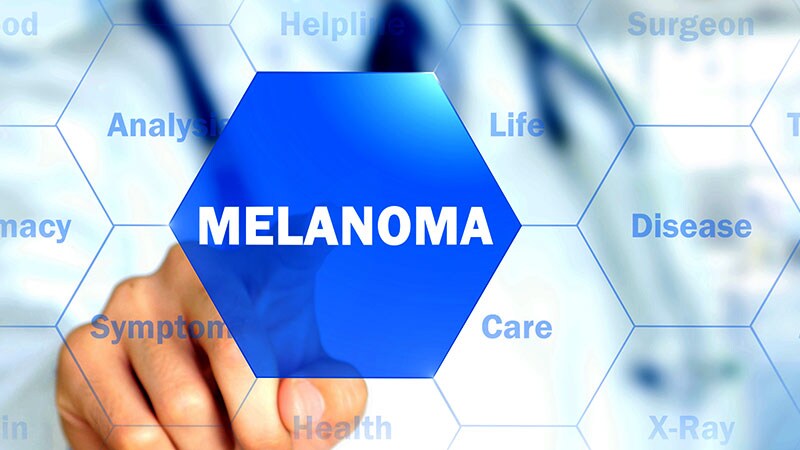 Nice Recommends New Treatment For Advanced Melanoma