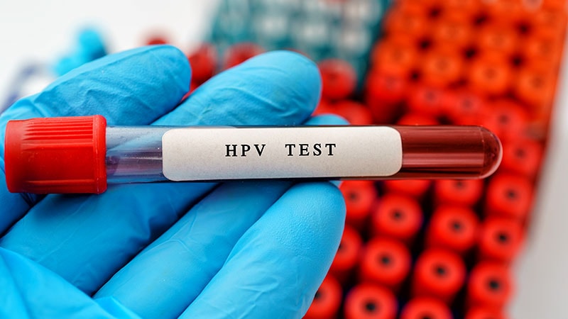 HPV Positive Test: How to Address Patients' Anxieties