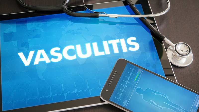 Updated ANCA Vasculitis Guideline Aims to Improve Care