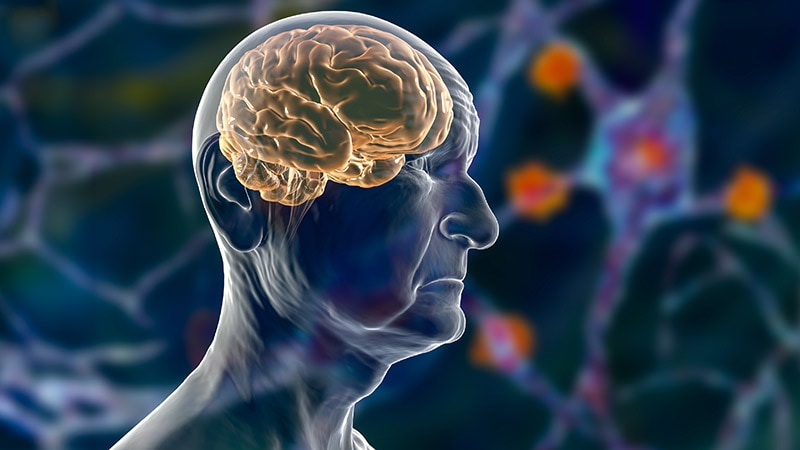 Chronic Pain Linked to Accelerated Brain Aging