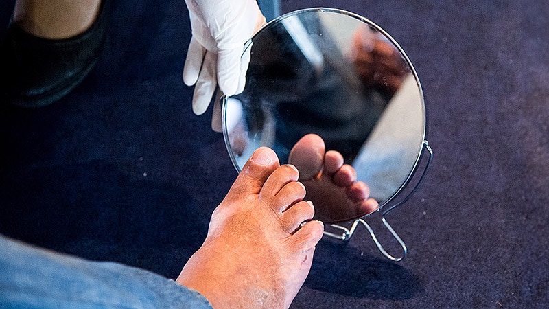 Can a Smart Sock Predict Diabetic Foot Problems Earlier?