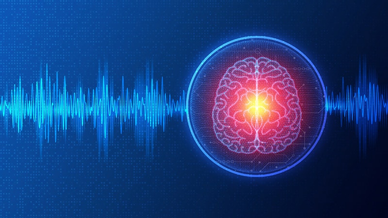 First Results of Magnetic Seizure Therapy for Bipolar Mania