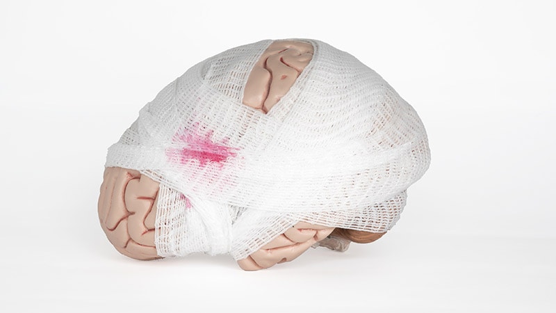 Millions in Lost Wages for Traumatic Brain Injury Survivors