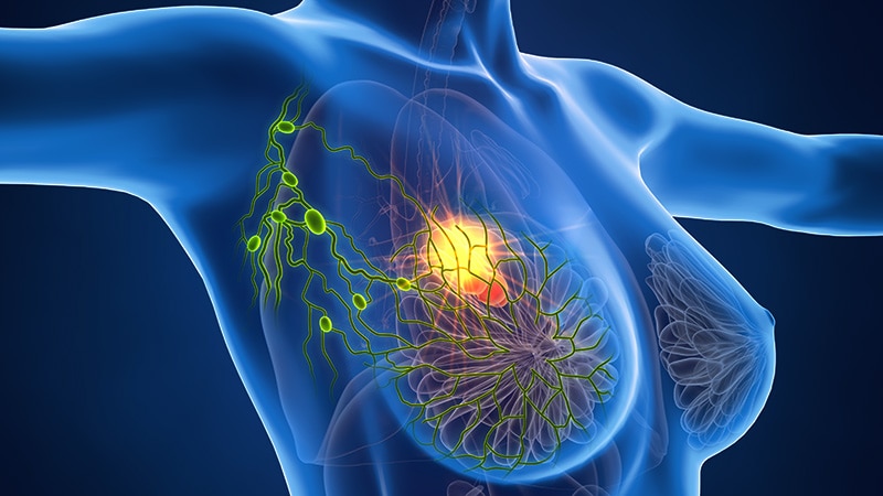 Gene Panel Predicts Early HER2+ Breast Cancer Prognosis