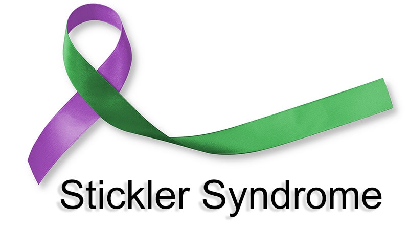 Retinal Detachment Still Sticky Issue for Stickler Syndrome