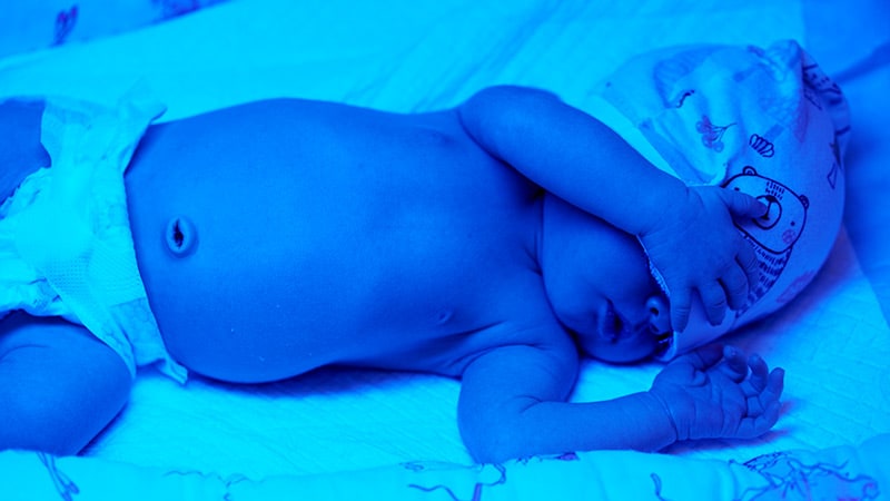 Early Screening: Shining a Light on Neonatal Jaundice