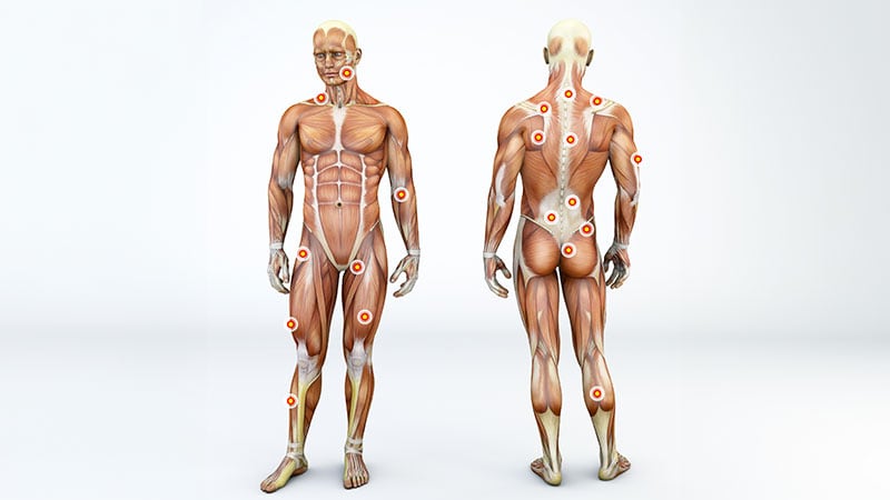 Fascia May Be the Lacking Hyperlink in Musculoskeletal Ache