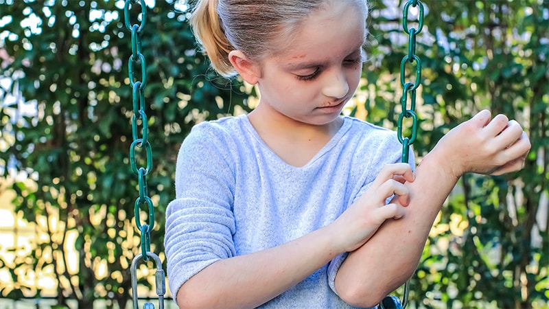 Which Allergens Most Affect Children Worldwide?